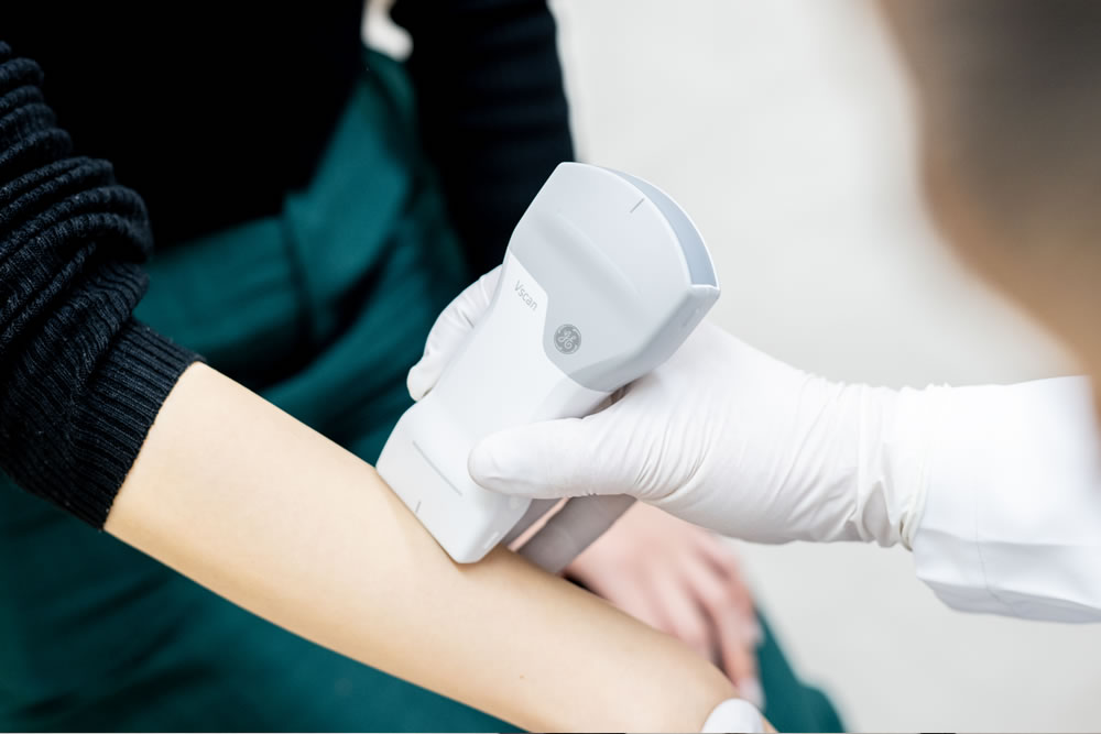 超音波画像診断装置