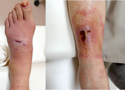 動物によるケガ